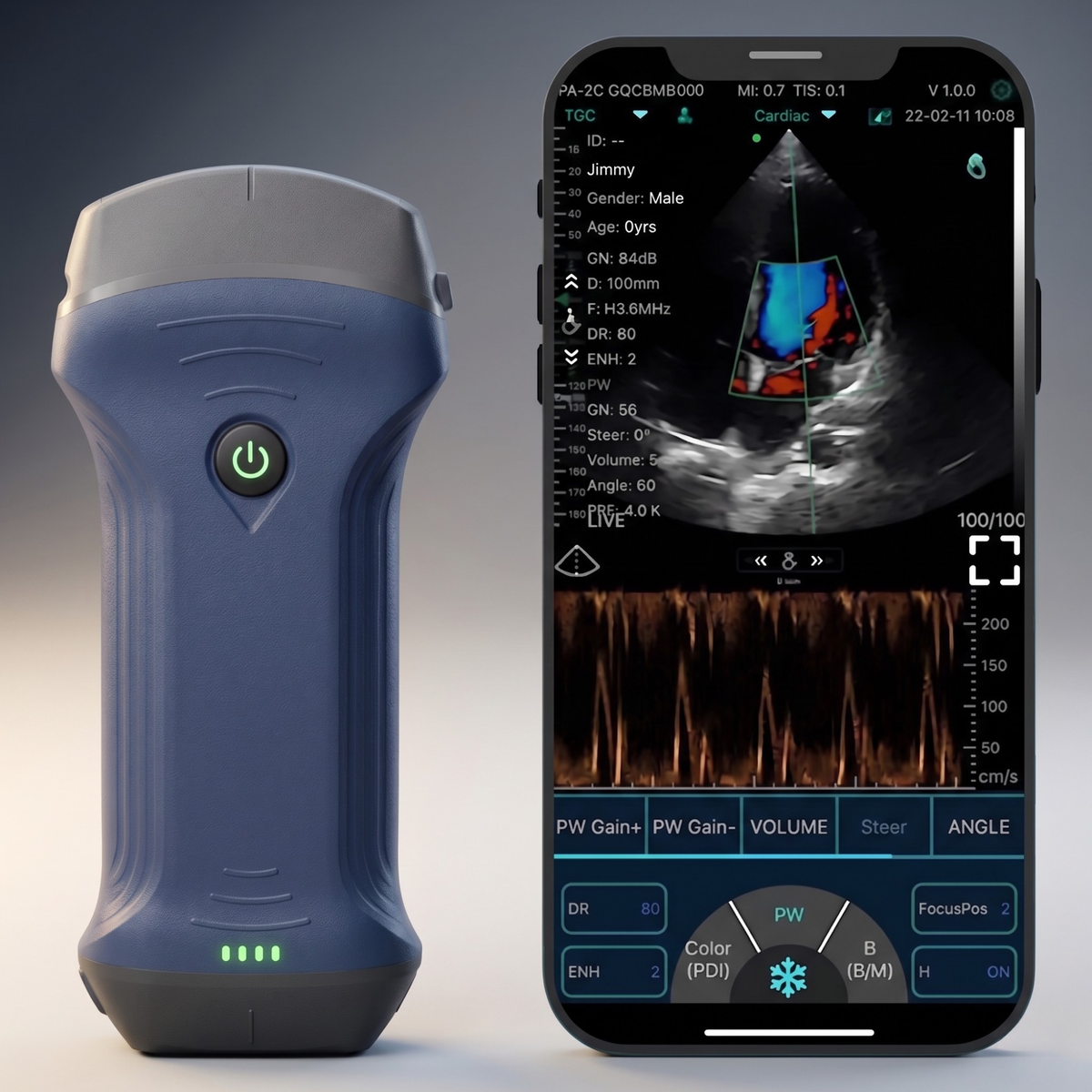 Ultrassom Konted Pro 3x1 Sem Fio e com Cabeça Dupla