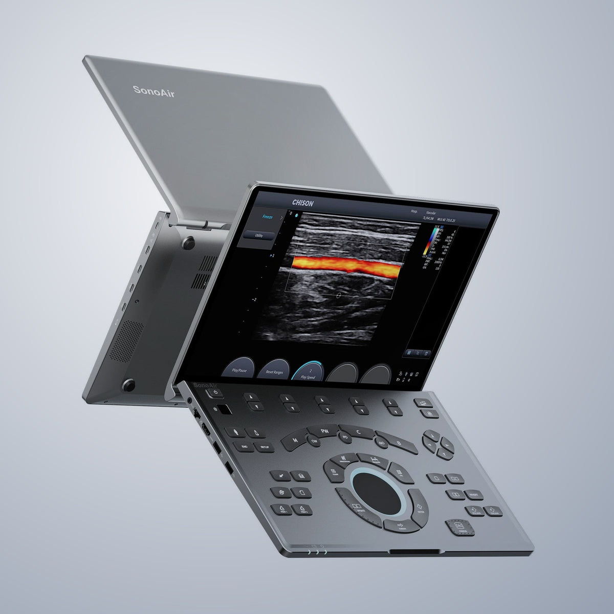 SonoAir 30